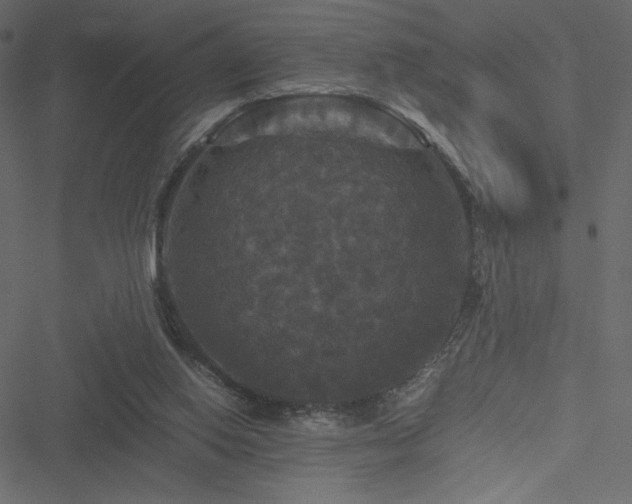 X0000051240062200506171121