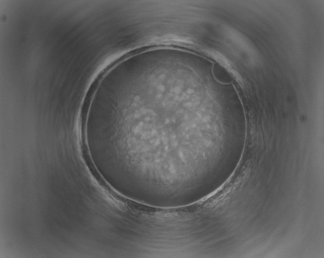 X0000051241032200506171105