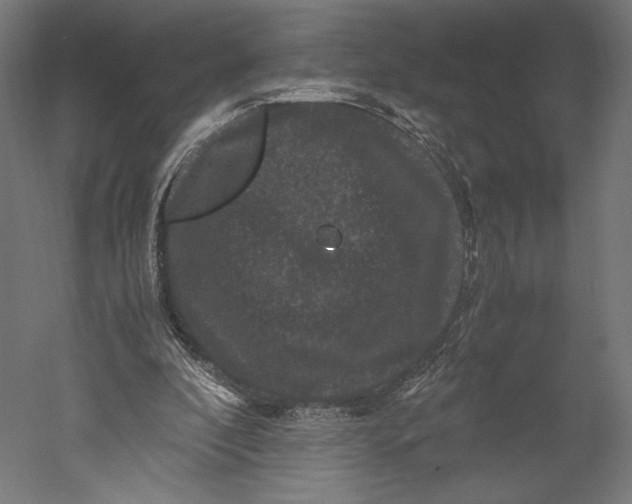 X0000051240296200507011633