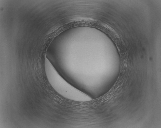 X0000051260869200506170814