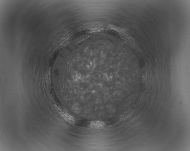 X0000051260369200507011725