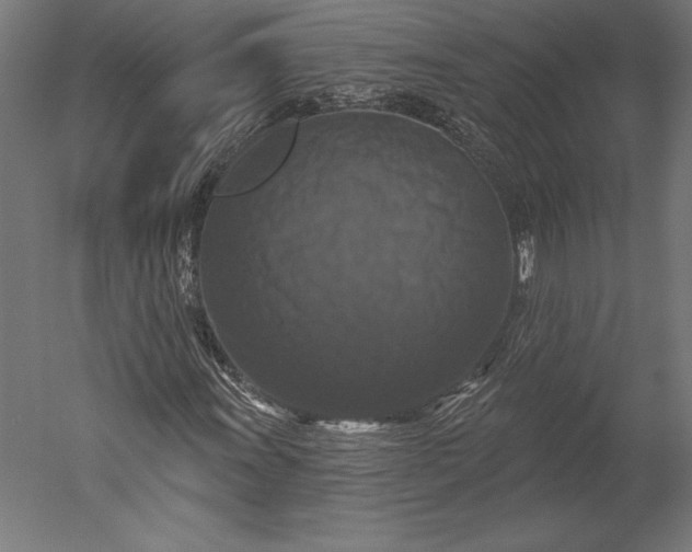 X0000051261011200507011713