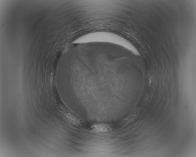 X0000051260417200507082222
