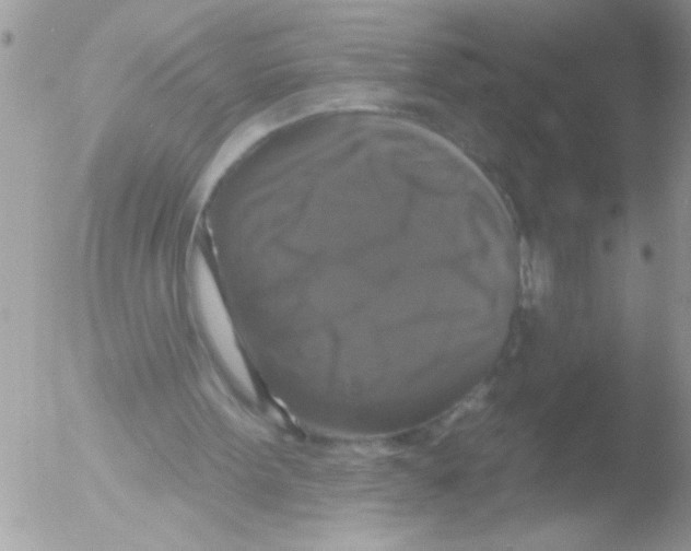 X0000051260099200507152226