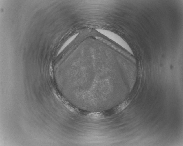 X0000051260280200507152224