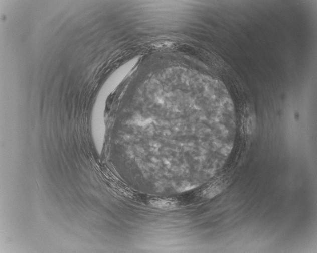 X0000051260561200507152218