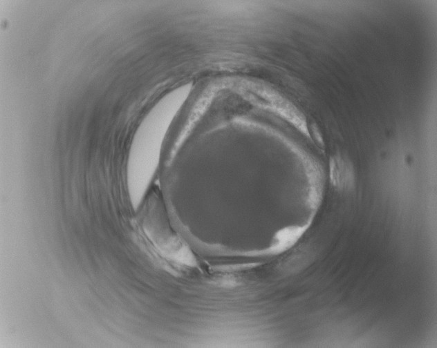 X0000051261155200507152208