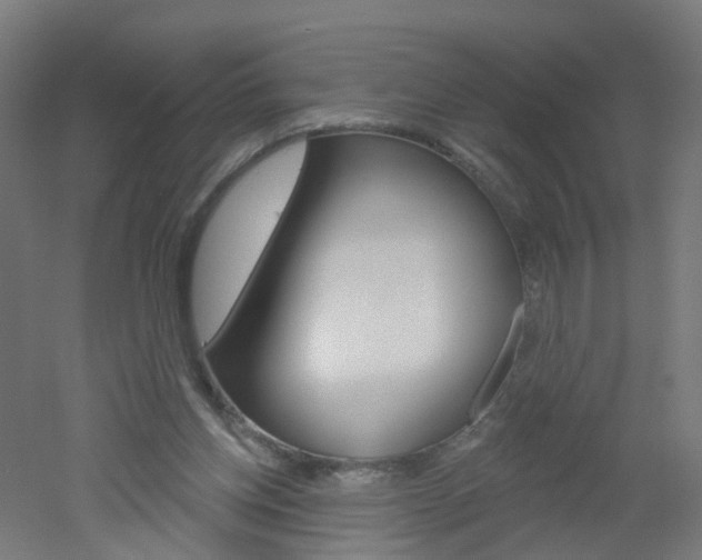 X0000051860158200506241011