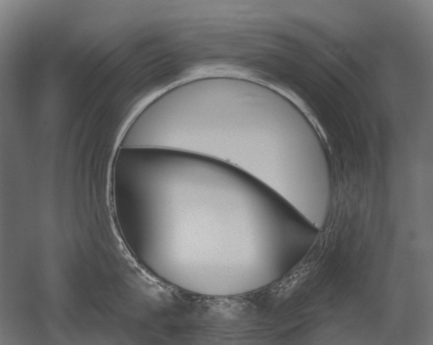 X0000051860815200506241000