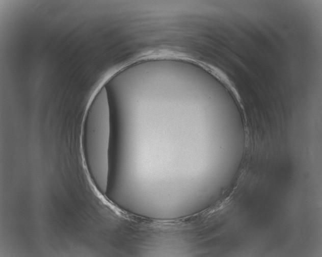 X0000051860863200506241000