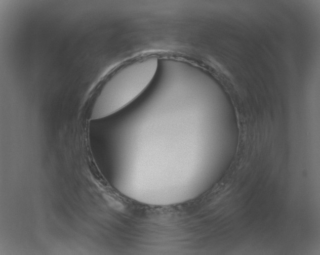 X0000051861208200506240953
