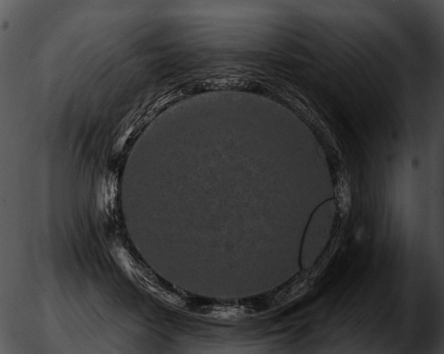 X0000051860458200507012345