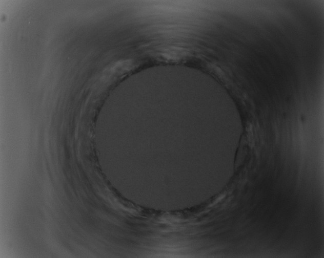 X0000051861009200507012335