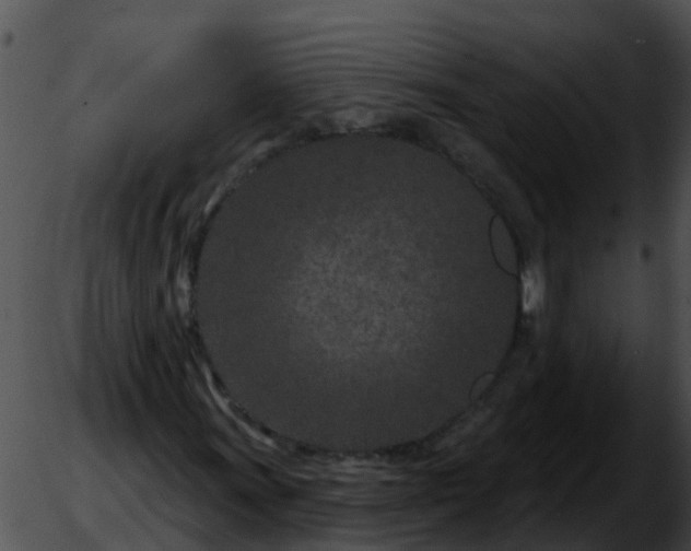 X0000051861011200507012335