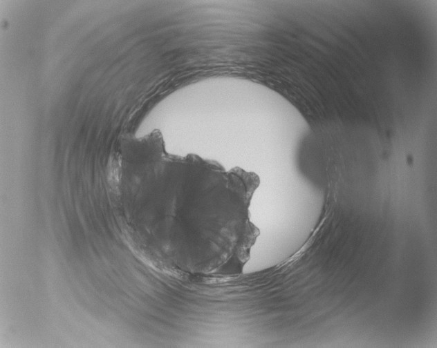 X0000051860179200507151830