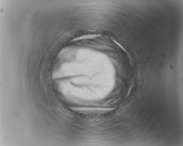 X0000051860817200507151818