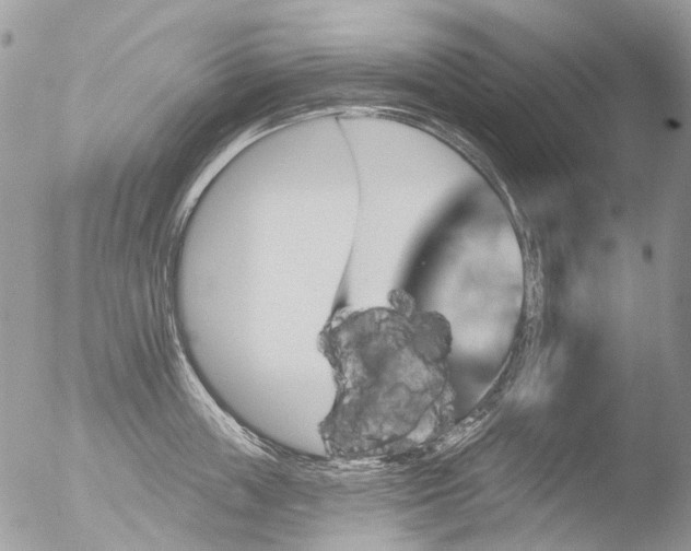 X0000051860859200507151818