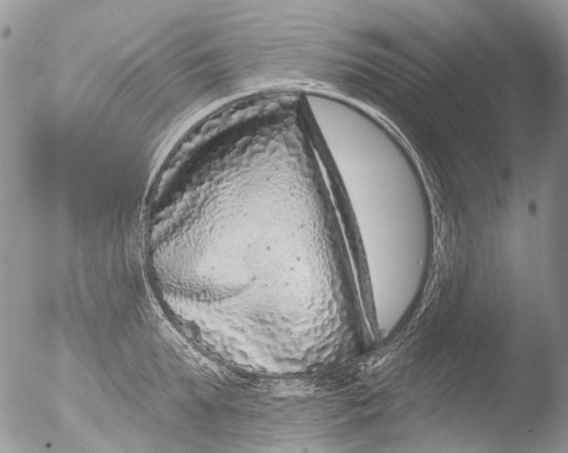 X0000051860903200507151817