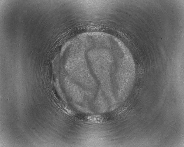 X0000051860761200507221857