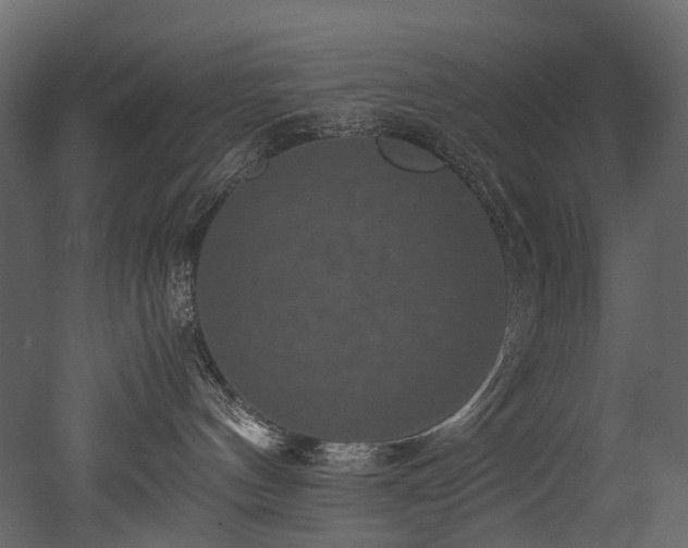 X0000051880144200506241423