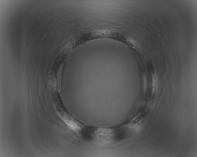 X0000051880617200506241415