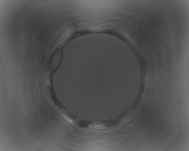 X0000051880689200506241414