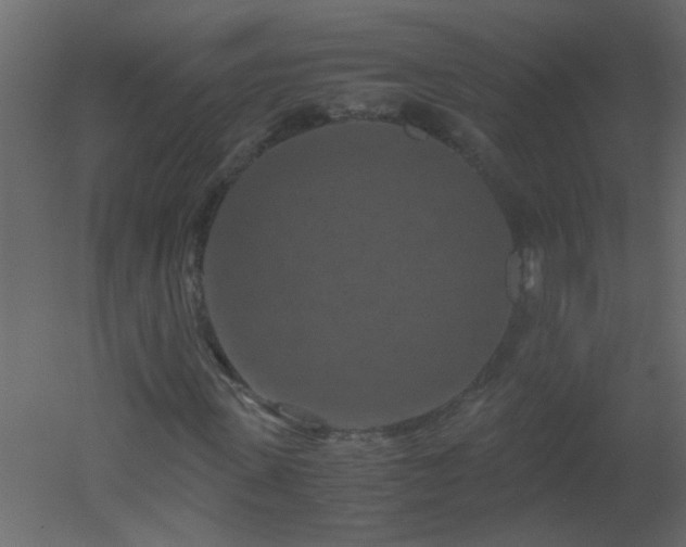 X0000051880915200506241409