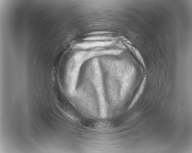 X0000051880215200507221958