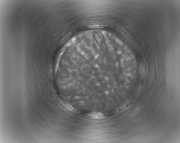 X0000051890322200507222022