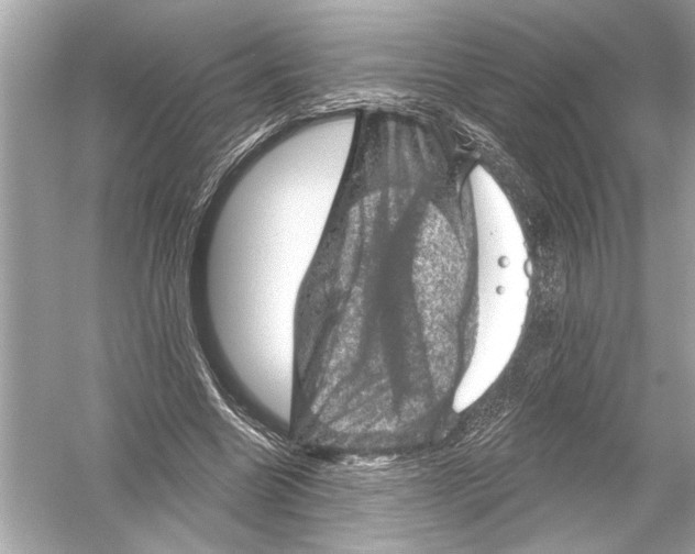 X0000051890538200507222018