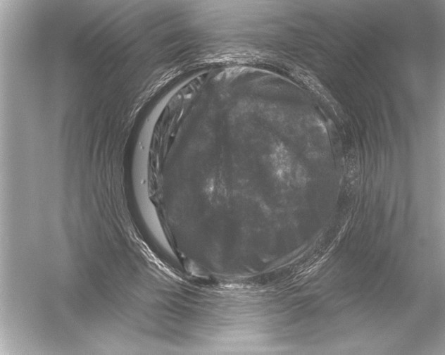 X0000051890585200507222018