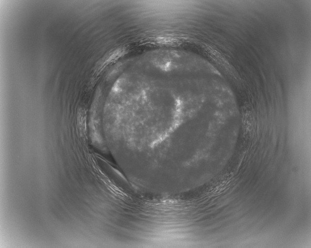 X0000051890593200507222018