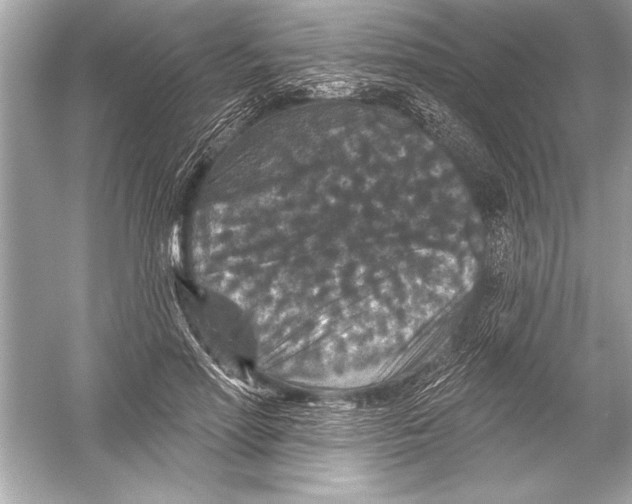 X0000051890598200507222018