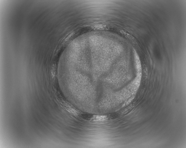 X0000051890665200507222017