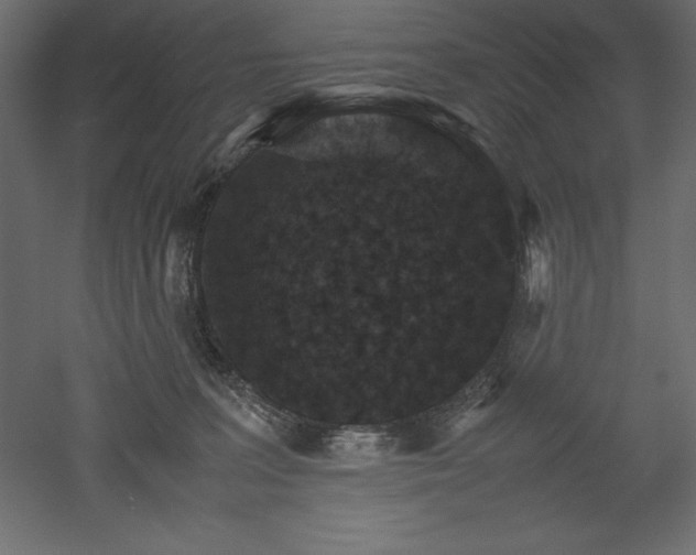X0000051900227200507011516