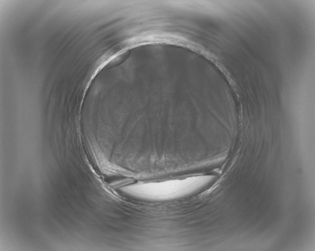 X0000051901529200507222029