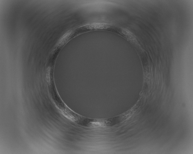 X0000051920167200507011609