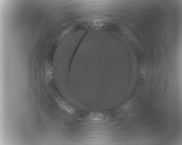 X0000051920818200507222132