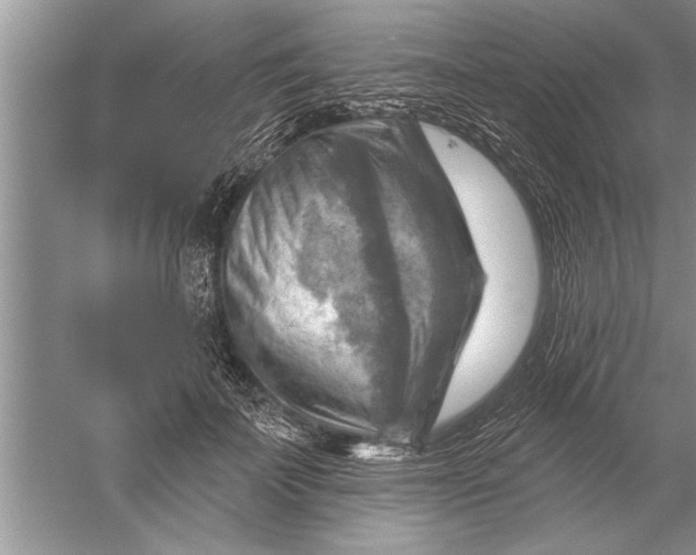 X0000052570699200507152252