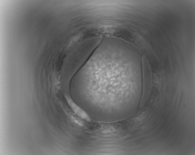 X0000052570818200507152250