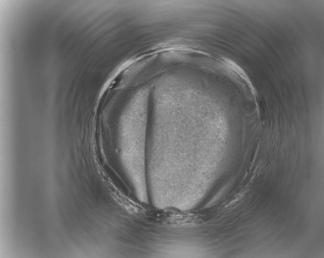 X0000052571146200507152245