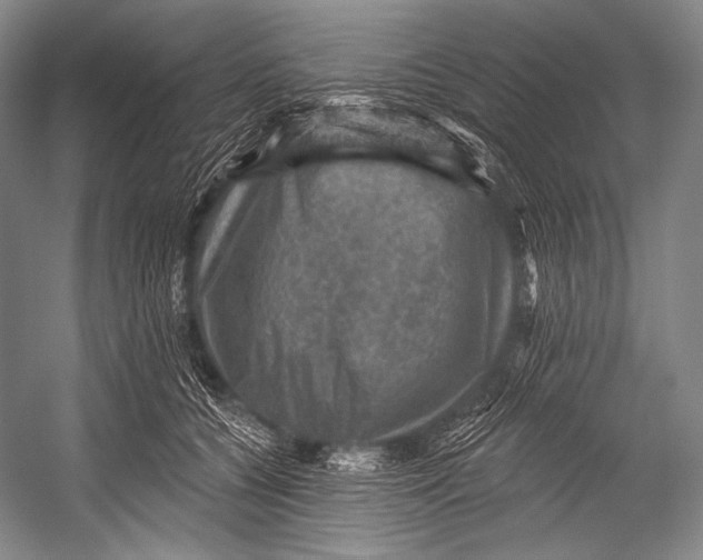 X0000052570560200507221505