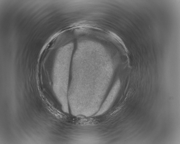 X0000052571146200507221455