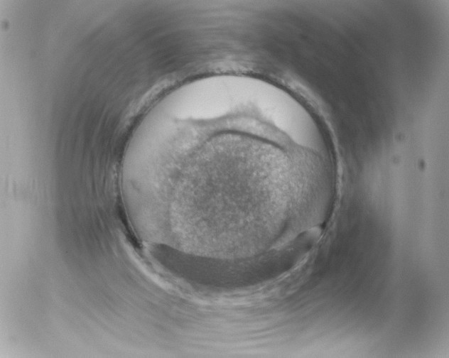 X0000052570009200507292018