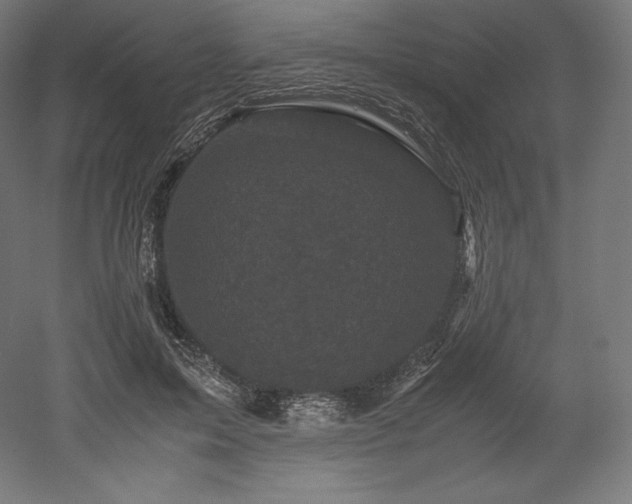 X0000052650599200507011414