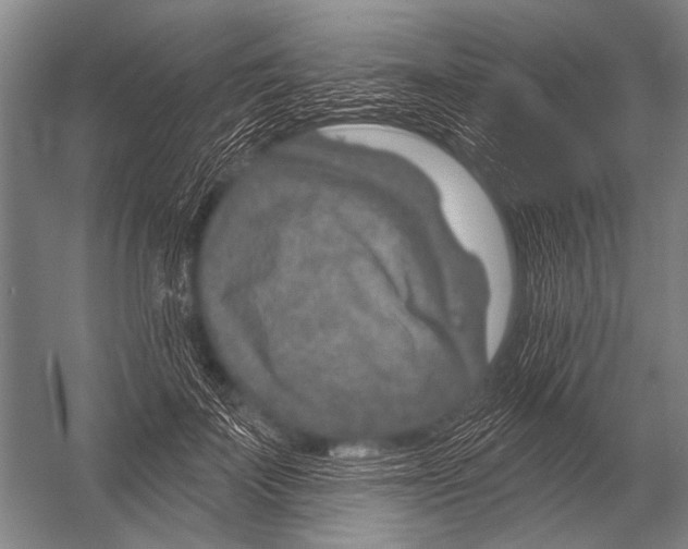 X0000052960699200507300111