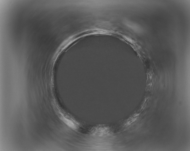 X0000052980247200507151835