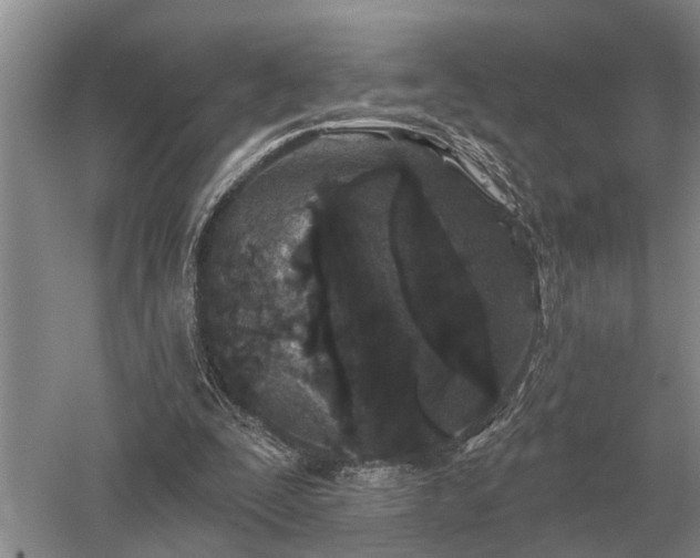 X0000052980295200507151835