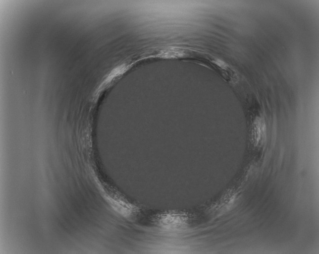 X0000052980303200507151835