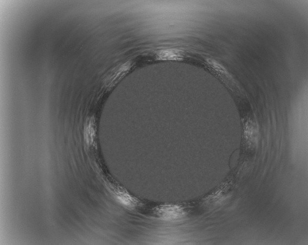 X0000052980322200507151835